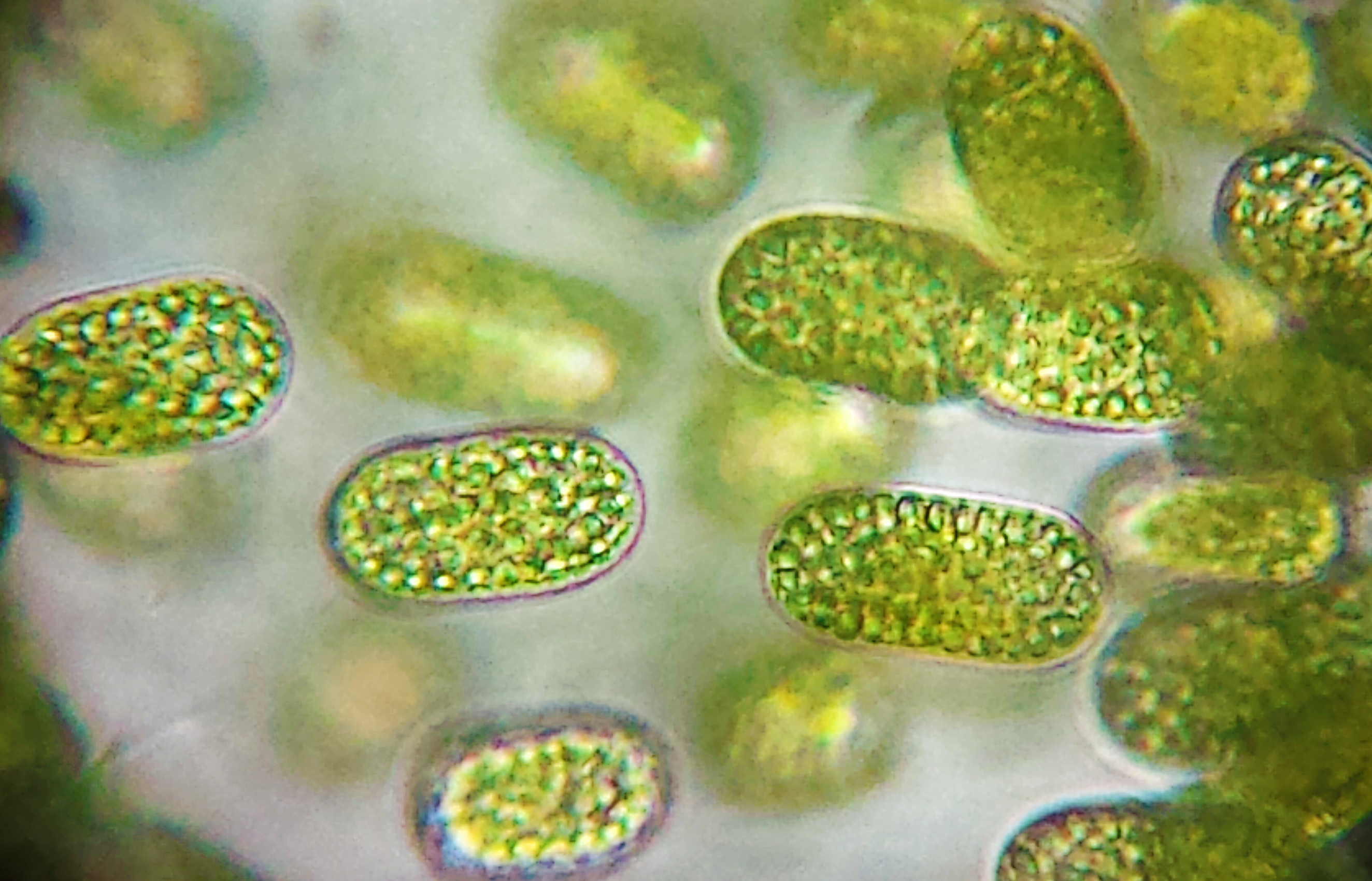 Простейшие водоросли грибы. Цианобактерии и протисты. Синезелёные водоросли цианобактерии. Фотосинтезирующие цианобактерии. Цианобактерии сине-зеленые водоросли.